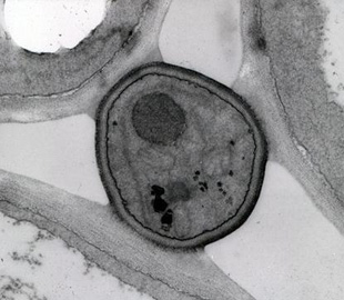 植物の細胞間隙に存在するエンドファイト菌糸の切断面（真ん中の丸いもの）の透過電子顕微鏡写真